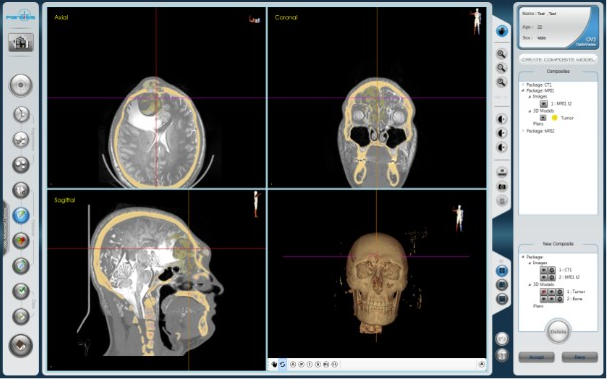 ایجاد مدل ترکیبی IV2